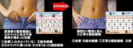 �C�����F��(Invel)