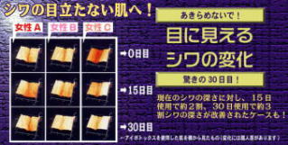 アイボトックス