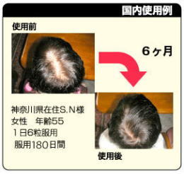 黄金キビの効果